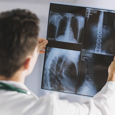 Grupo de Pesquisa convoca volunt�rios para avalia��o respirat�ria e da coluna lombar
